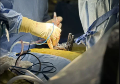 minimally invasive spine surgery