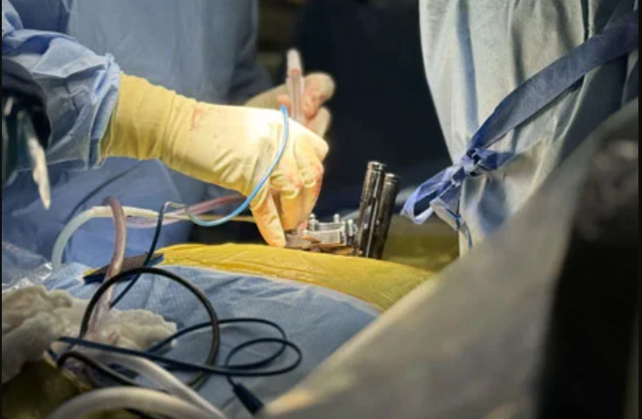 minimally invasive spine surgery